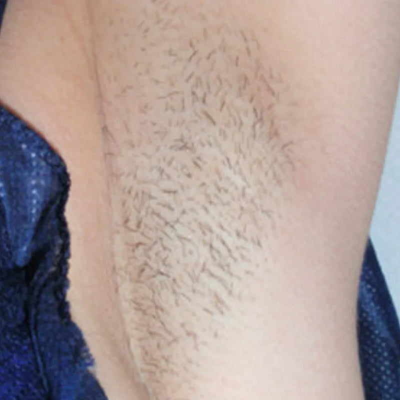 First Signs of Reduction