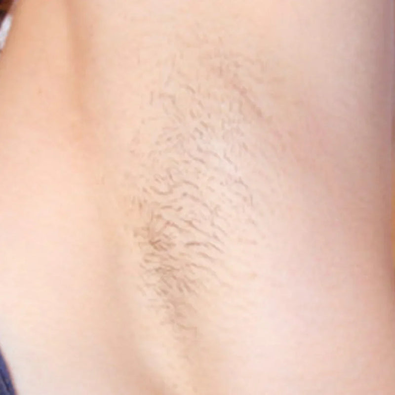 Visible Thinning
